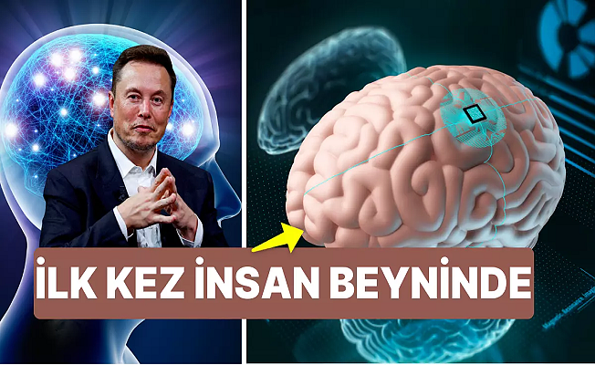 Elon Musk, Neuralink'in beyin çipi Telepati'nin ilk kez bir insana yerleştirildiğini duyurdu