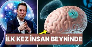 Elon Musk, Neuralink'in beyin çipi Telepati'nin ilk kez bir insana yerleştirildiğini duyurdu