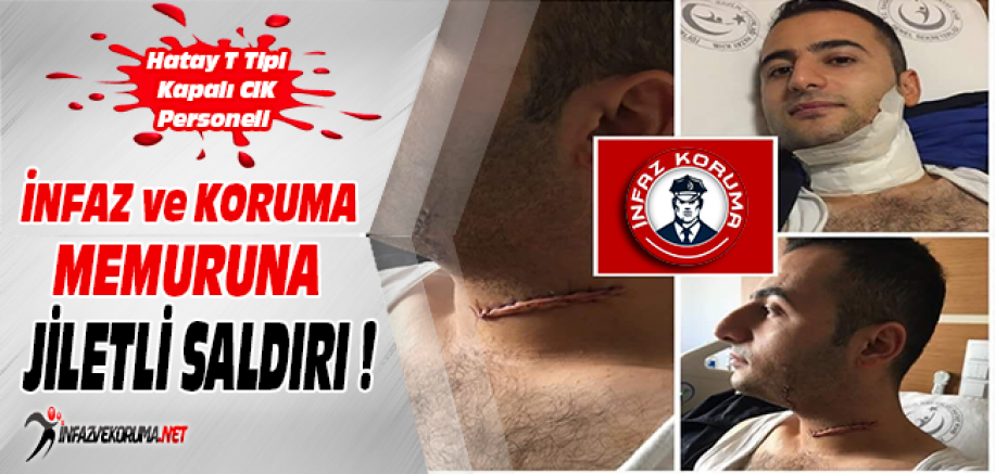 Hatay T Tipi Kapalı CİK Personeli İKM'ye Jiletli Saldırı !